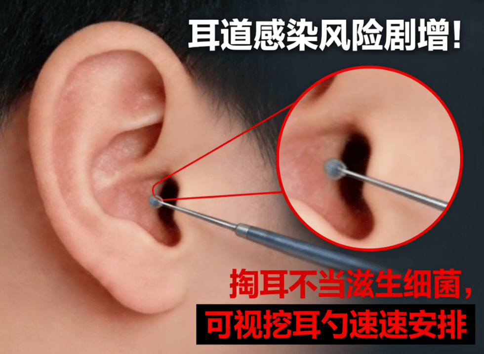 必入好用的掏耳勺清单!可视掏耳勺选哪个牌子的好?避坑指南!
