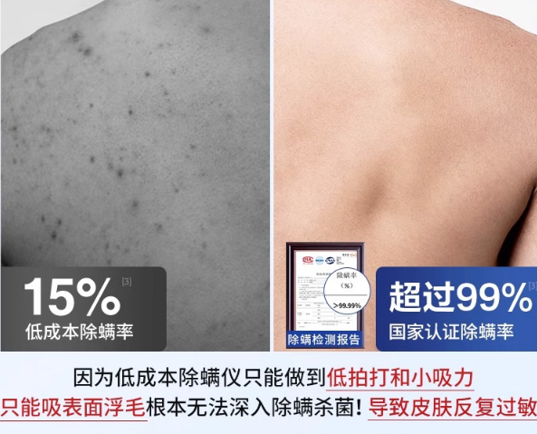 国产除螨仪哪个牌子好？除螨仪什么品牌好？好评如潮的除螨仪排行榜前十名，避坑指南收好！